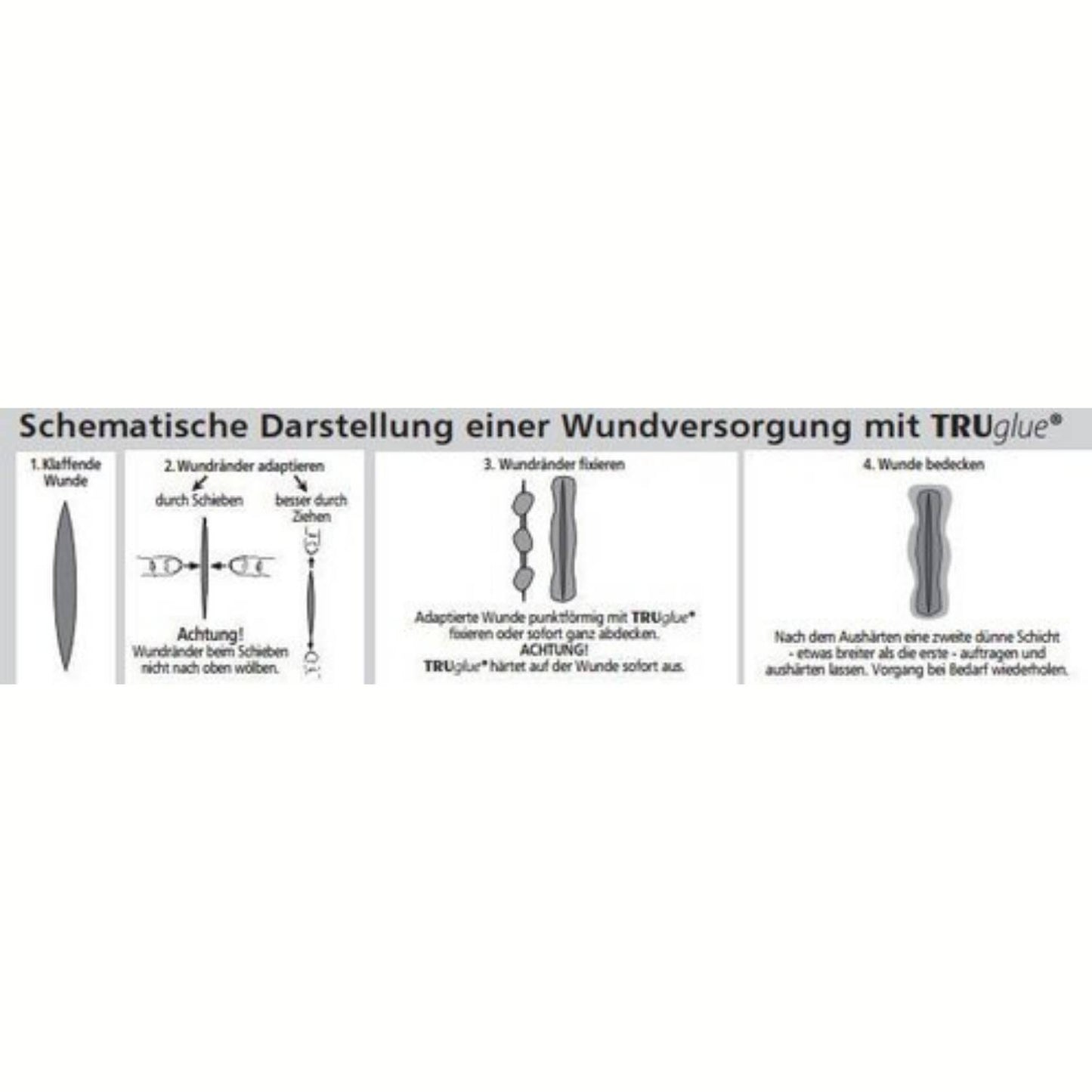 TRUGLUE Haut- und Wundkleber zur Versorgung von Hautläsionen - 5 x 0,3 ml